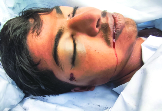 Image of হযরত বিল্লাল